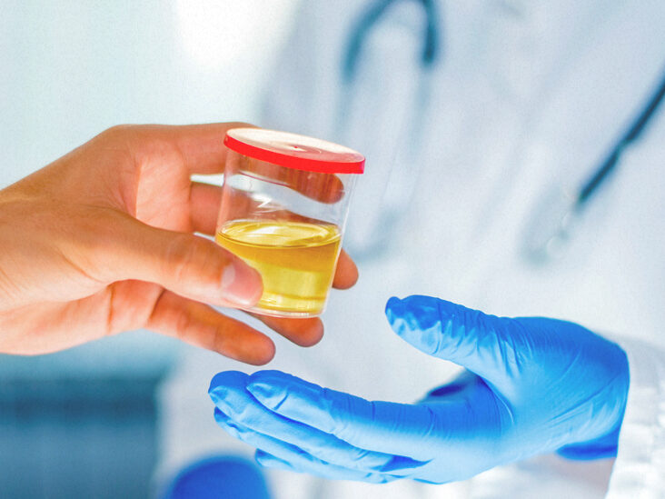 An Overview On Synthetic Urine Kit