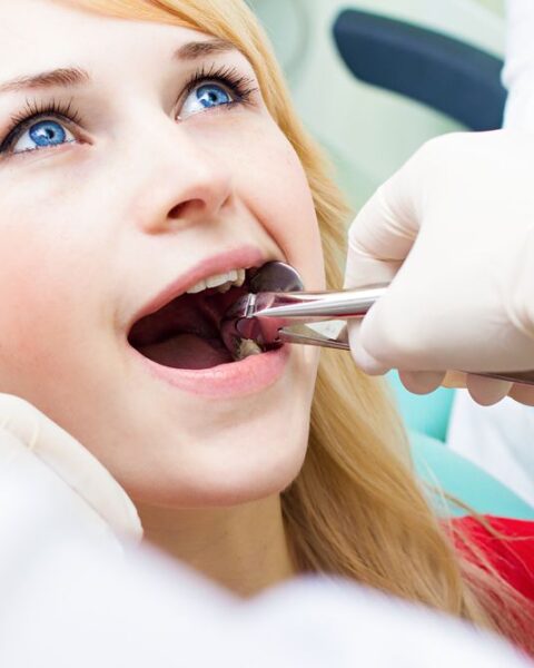 how long should you wait to exercise after tooth extraction